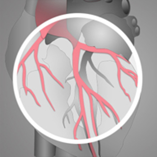 CORONARY INTERVENTIONS